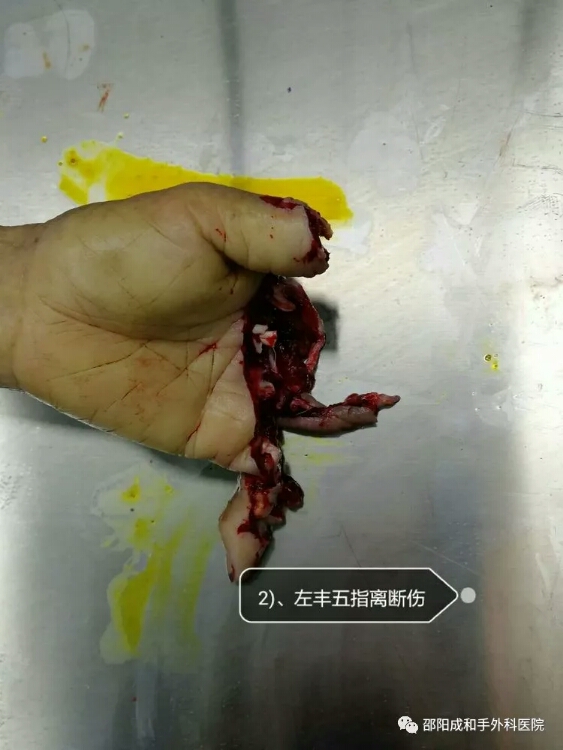 邵陽創傷骨科,邵陽風濕病區,邵陽骨質增生,邵陽關節病區,邵陽頸椎病區
