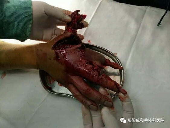 邵陽創傷骨科,邵陽風濕病區,邵陽骨質增生,邵陽關節病區,邵陽頸椎病區