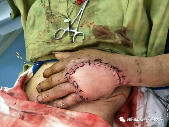 邵陽創傷骨科,邵陽風濕病區,邵陽骨質增生,邵陽關節病區,邵陽頸椎病區