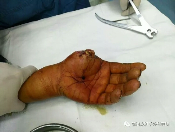 邵陽創傷骨科,邵陽風濕病區,邵陽骨質增生,邵陽關節病區,邵陽頸椎病區