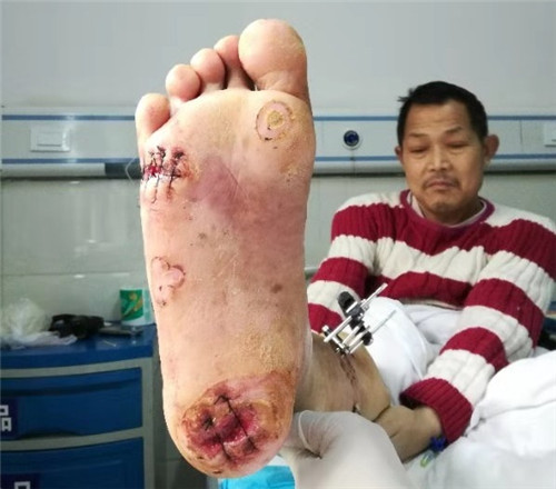 邵陽創傷骨科,邵陽風濕病區,邵陽骨質增生,邵陽關節病區,邵陽頸椎病區