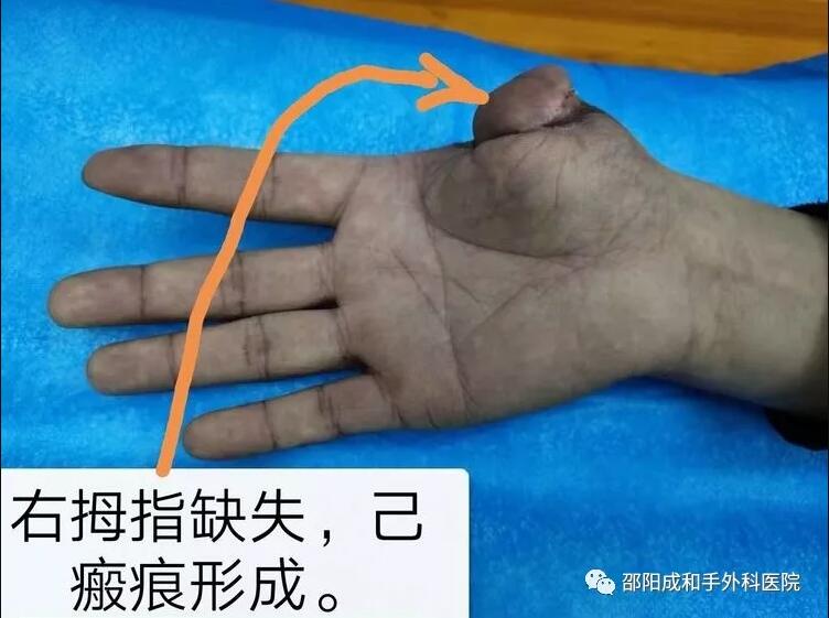 邵陽創傷骨科,邵陽風濕病區,邵陽骨質增生,邵陽關節病區,邵陽頸椎病區