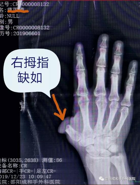 邵陽創傷骨科,邵陽風濕病區,邵陽骨質增生,邵陽關節病區,邵陽頸椎病區