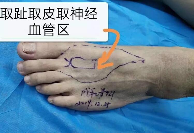 邵陽創傷骨科,邵陽風濕病區,邵陽骨質增生,邵陽關節病區,邵陽頸椎病區
