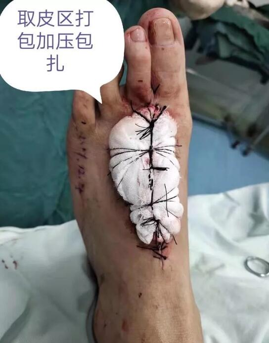 邵陽創傷骨科,邵陽風濕病區,邵陽骨質增生,邵陽關節病區,邵陽頸椎病區