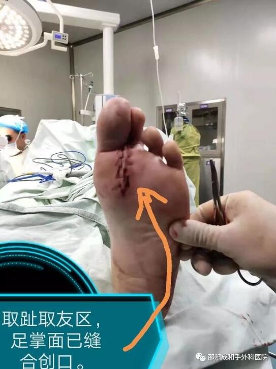 邵陽創傷骨科,邵陽風濕病區,邵陽骨質增生,邵陽關節病區,邵陽頸椎病區