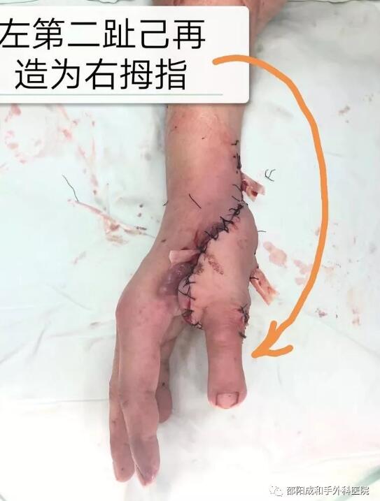 邵陽創傷骨科,邵陽風濕病區,邵陽骨質增生,邵陽關節病區,邵陽頸椎病區