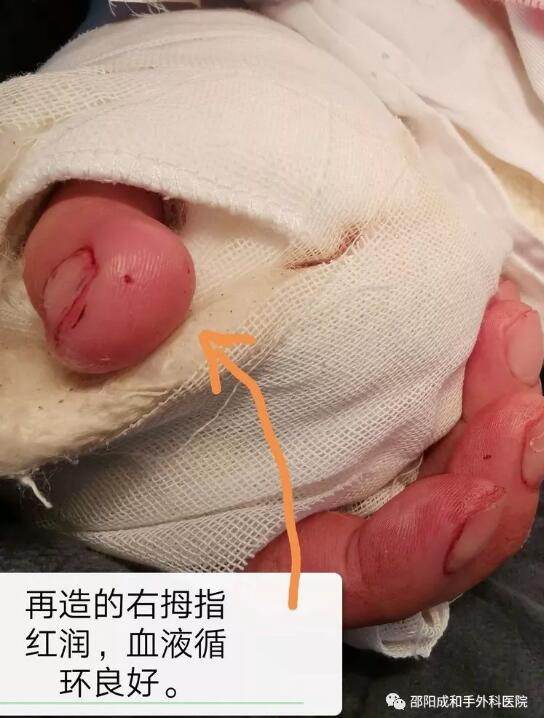 邵陽創傷骨科,邵陽風濕病區,邵陽骨質增生,邵陽關節病區,邵陽頸椎病區