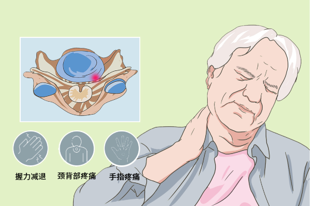 邵陽創傷骨科,邵陽風濕病區,邵陽骨質增生,邵陽關節病區,邵陽頸椎病區