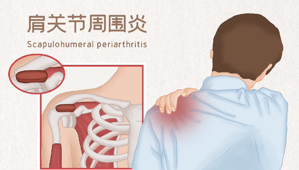 邵陽創傷骨科,邵陽風濕病區,邵陽骨質增生,邵陽關節病區,邵陽頸椎病區
