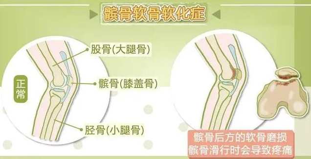 邵陽創傷骨科,邵陽風濕病區,邵陽骨質增生,邵陽關節病區,邵陽頸椎病區