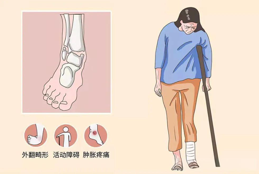 邵陽創傷骨科,邵陽風濕病區,邵陽骨質增生,邵陽關節病區,邵陽頸椎病區