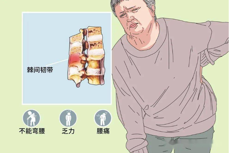 邵陽創傷骨科,邵陽風濕病區,邵陽骨質增生,邵陽關節病區,邵陽頸椎病區