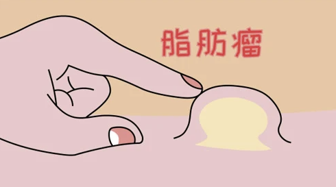 邵陽創傷骨科,邵陽風濕病區,邵陽骨質增生,邵陽關節病區,邵陽頸椎病區
