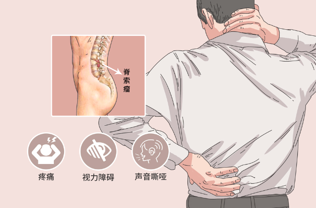 邵陽創傷骨科,邵陽風濕病區,邵陽骨質增生,邵陽關節病區,邵陽頸椎病區
