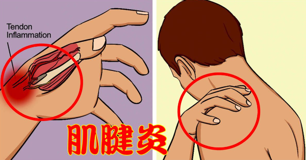 邵陽創傷骨科,邵陽風濕病區,邵陽骨質增生,邵陽關節病區,邵陽頸椎病區