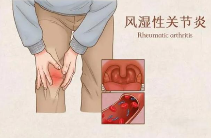 邵陽創傷骨科,邵陽風濕病區,邵陽骨質增生,邵陽關節病區,邵陽頸椎病區
