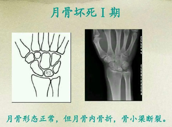 邵陽創傷骨科,邵陽風濕病區,邵陽骨質增生,邵陽關節病區,邵陽頸椎病區