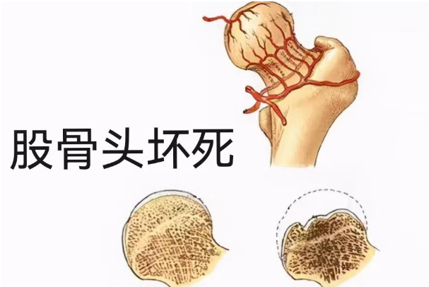 邵陽創傷骨科,邵陽風濕病區,邵陽骨質增生,邵陽關節病區,邵陽頸椎病區