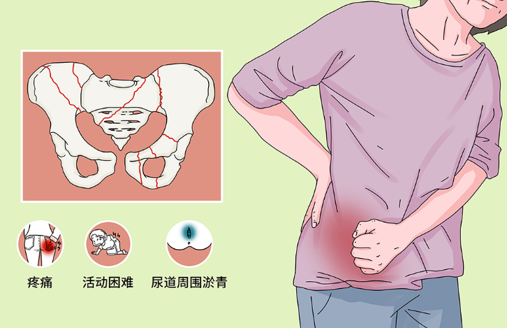 邵陽創傷骨科,邵陽風濕病區,邵陽骨質增生,邵陽關節病區,邵陽頸椎病區