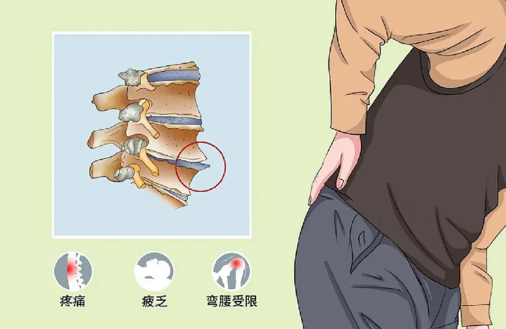 邵陽創傷骨科,邵陽風濕病區,邵陽骨質增生,邵陽關節病區,邵陽頸椎病區