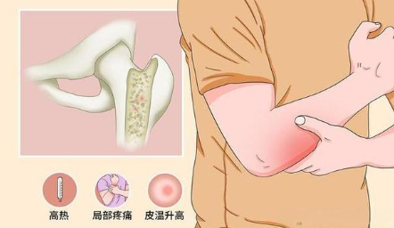 邵陽創傷骨科,邵陽風濕病區,邵陽骨質增生,邵陽關節病區,邵陽頸椎病區
