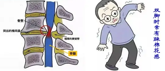 邵陽創傷骨科,邵陽風濕病區,邵陽骨質增生,邵陽關節病區,邵陽頸椎病區