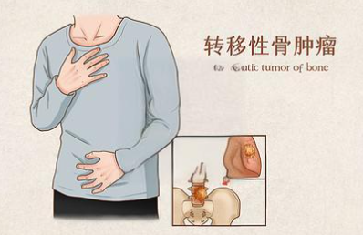 邵陽創傷骨科,邵陽風濕病區,邵陽骨質增生,邵陽關節病區,邵陽頸椎病區