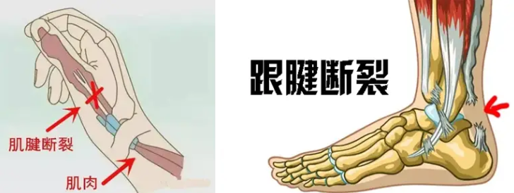 邵陽創傷骨科,邵陽風濕病區,邵陽骨質增生,邵陽關節病區,邵陽頸椎病區