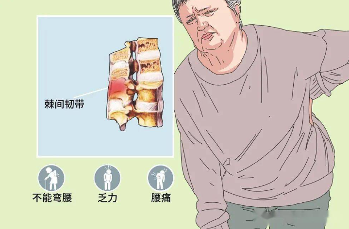 邵陽創傷骨科,邵陽風濕病區,邵陽骨質增生,邵陽關節病區,邵陽頸椎病區