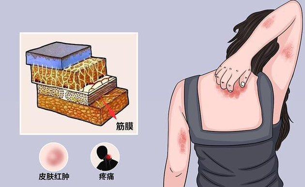 邵陽創傷骨科,邵陽風濕病區,邵陽骨質增生,邵陽關節病區,邵陽頸椎病區