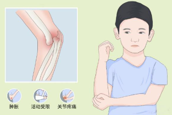 邵陽創傷骨科,邵陽風濕病區,邵陽骨質增生,邵陽關節病區,邵陽頸椎病區