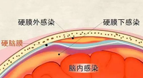 邵陽創傷骨科,邵陽風濕病區,邵陽骨質增生,邵陽關節病區,邵陽頸椎病區
