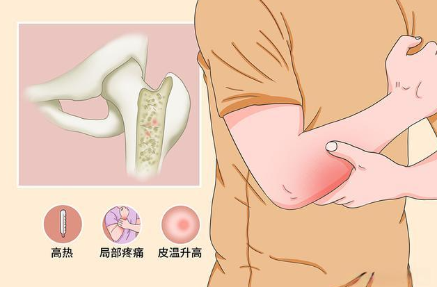 邵陽創傷骨科,邵陽風濕病區,邵陽骨質增生,邵陽關節病區,邵陽頸椎病區