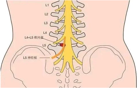 邵陽創傷骨科,邵陽風濕病區,邵陽骨質增生,邵陽關節病區,邵陽頸椎病區