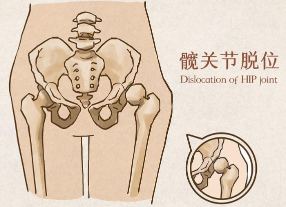 邵陽創傷骨科,邵陽風濕病區,邵陽骨質增生,邵陽關節病區,邵陽頸椎病區