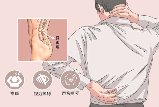 邵陽創傷骨科,邵陽風濕病區,邵陽骨質增生,邵陽關節病區,邵陽頸椎病區