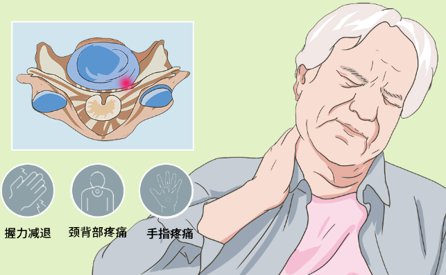 邵陽創傷骨科,邵陽風濕病區,邵陽骨質增生,邵陽關節病區,邵陽頸椎病區