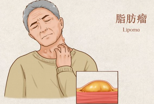 邵陽創傷骨科,邵陽風濕病區,邵陽骨質增生,邵陽關節病區,邵陽頸椎病區