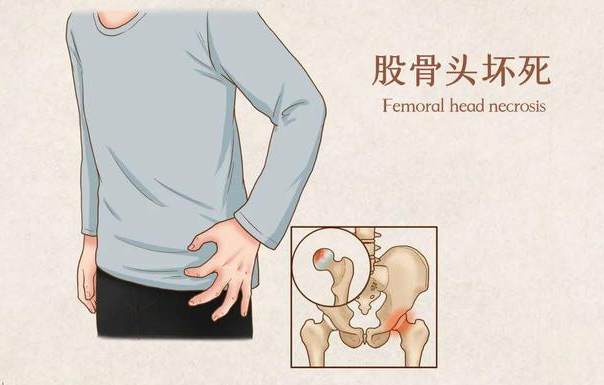 邵陽創傷骨科,邵陽風濕病區,邵陽骨質增生,邵陽關節病區,邵陽頸椎病區