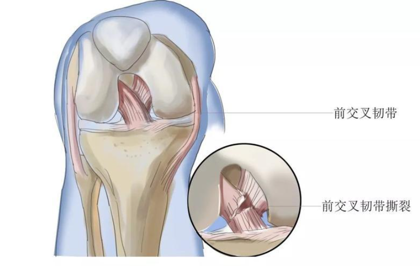 邵陽創傷骨科,邵陽風濕病區,邵陽骨質增生,邵陽關節病區,邵陽頸椎病區