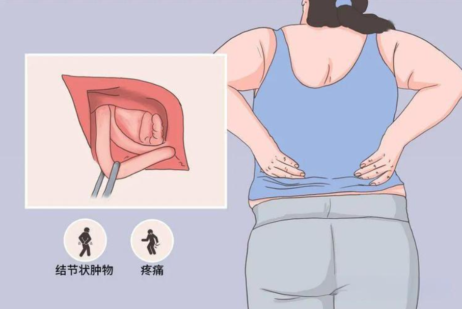 邵陽創傷骨科,邵陽風濕病區,邵陽骨質增生,邵陽關節病區,邵陽頸椎病區