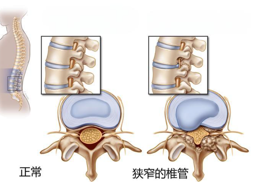 邵陽創傷骨科,邵陽風濕病區,邵陽骨質增生,邵陽關節病區,邵陽頸椎病區