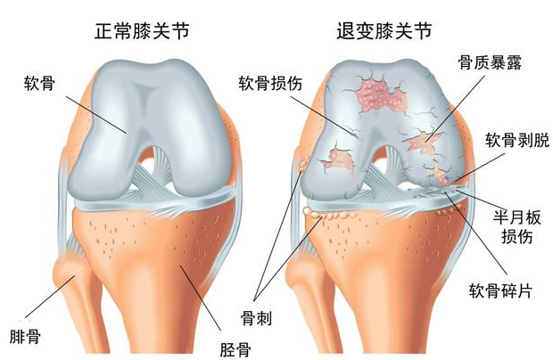 邵陽創傷骨科,邵陽風濕病區,邵陽骨質增生,邵陽關節病區,邵陽頸椎病區