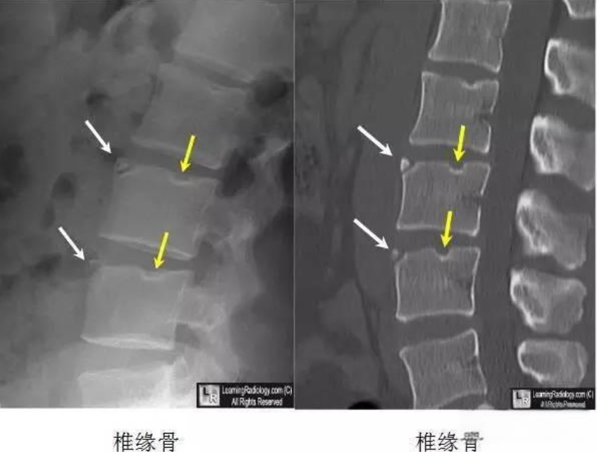 邵陽創傷骨科,邵陽風濕病區,邵陽骨質增生,邵陽關節病區,邵陽頸椎病區