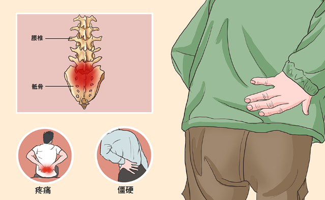 邵陽創傷骨科,邵陽風濕病區,邵陽骨質增生,邵陽關節病區,邵陽頸椎病區