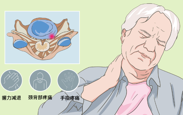 邵陽創傷骨科,邵陽風濕病區,邵陽骨質增生,邵陽關節病區,邵陽頸椎病區