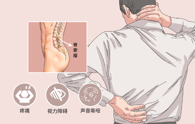 邵陽創傷骨科,邵陽風濕病區,邵陽骨質增生,邵陽關節病區,邵陽頸椎病區