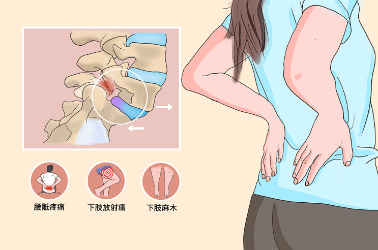 邵陽創傷骨科,邵陽風濕病區,邵陽骨質增生,邵陽關節病區,邵陽頸椎病區