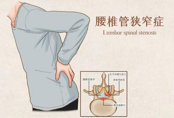 邵陽創傷骨科,邵陽風濕病區,邵陽骨質增生,邵陽關節病區,邵陽頸椎病區